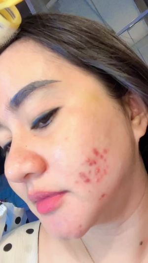 Video post by @lili.refliskin on TikTok