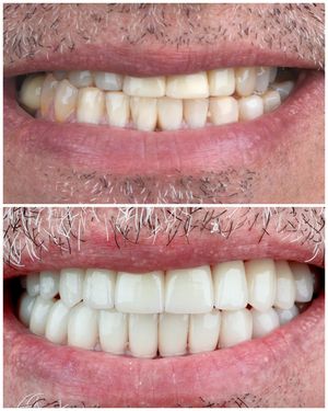 Image post by @sharpdentistry on Instagram