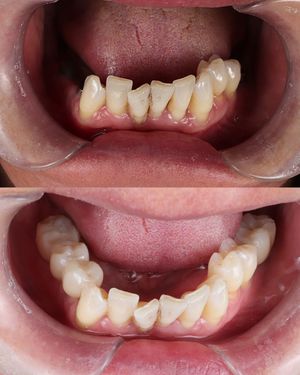 Image post by @fahaddentist on Instagram