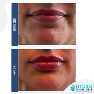 Image post by @hydromedspa on Facebook