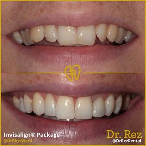 Image post by @drrezdental on Facebook