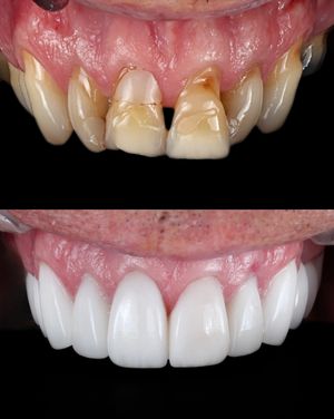 Image post by @fahaddentist on Instagram