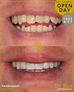 Image post by @drrezdental on Facebook