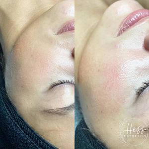 Image post by @HessBeautyBar on Facebook