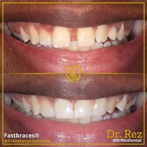 Image post by @drrezdental on Facebook