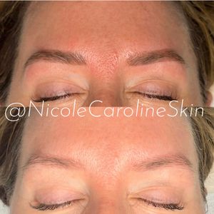 Image post by @nicolecarolineskin on Instagram