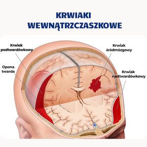 Image post by @neurochirurg_litak on Instagram