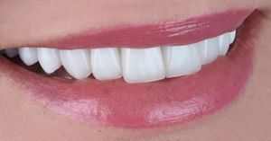 Image post by @sharpdentistry on Instagram