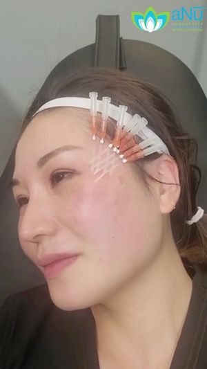Video post by @anuaestheticsandwellness on Instagram