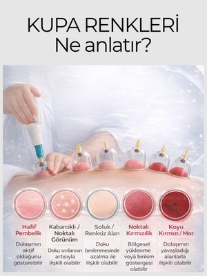 Image post by @drozlemteberik on Instagram