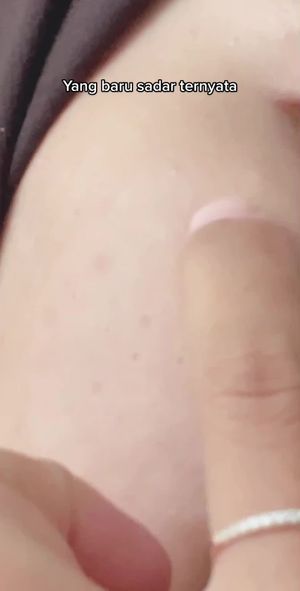 Video post by @lili.refliskin on TikTok