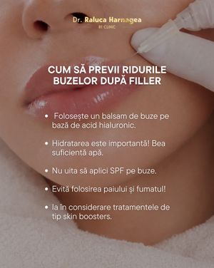 Image post by @dr.ralucaharnagea on Instagram