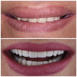Image post by @sharpdentistry on Instagram