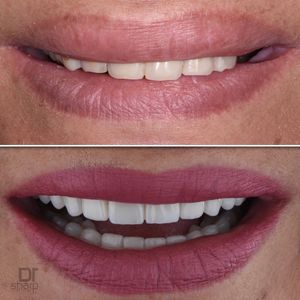Image post by @sharpdentistry on Instagram