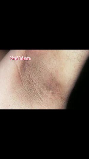 Video post by @lili.refliskin on TikTok
