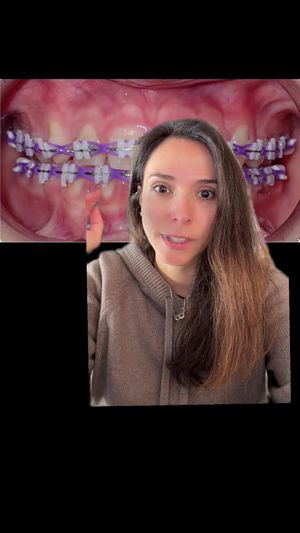 Video post by @weisstorortho on TikTok