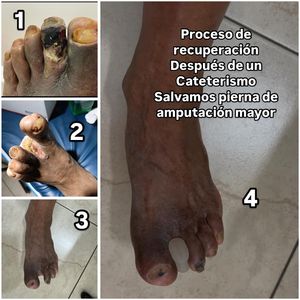 Image post by @dr.vicentevascular on Instagram