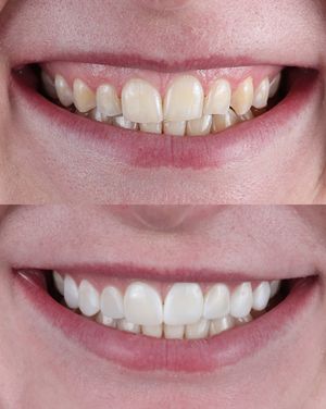Image post by @fahaddentist on Instagram