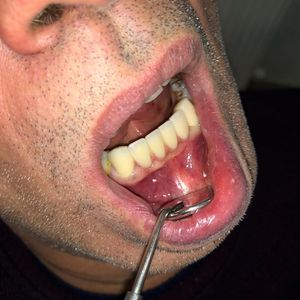 Image post by @dentamerzifon on Instagram