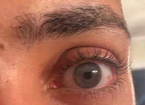 Image post by @irexlaser on Instagram