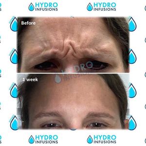 Image post by @hydromedspa on Facebook