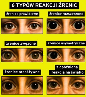 Image post by @neurochirurg_litak on Instagram
