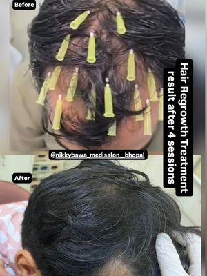 Image post by @nikkybawamedisalonbhopal on Instagram