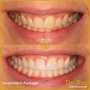Image post by @drrezdental on Facebook