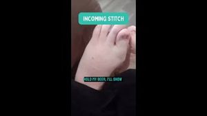 Video post by @thebunionking on YouTube