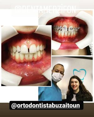 Image post by @dentamerzifon on Instagram