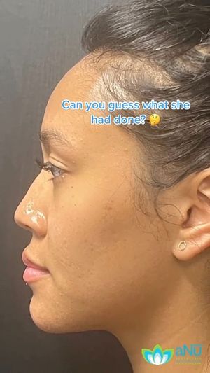 Video post by @anuaestheticsandwellness on Instagram