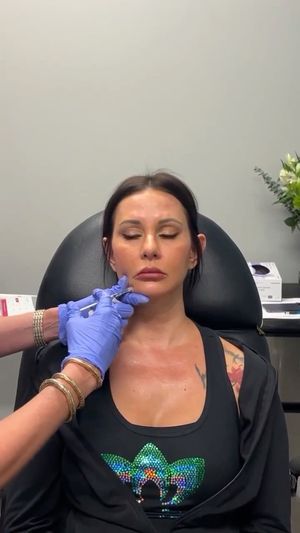 Video post by @anuaestheticsandwellness on Instagram