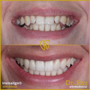 Image post by @drrezdental on Facebook