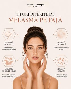 Image post by @dr.ralucaharnagea on Instagram