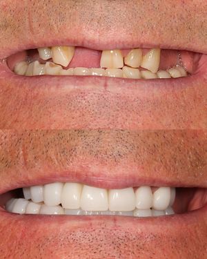Image post by @fahaddentist on Instagram
