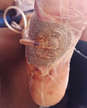 Image post by @dr.vicentevascular on Instagram