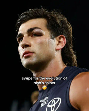 Image post by @adelaidefc on TikTok