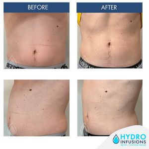 Image post by @hydromedspa on Facebook