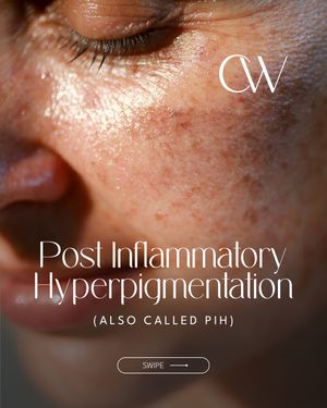 Image post by @carolinewatsonbeauty on Instagram