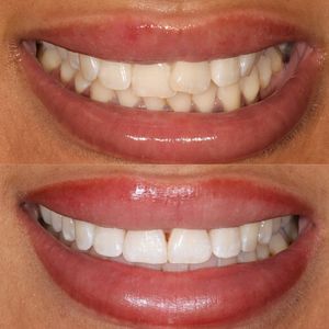 Image post by @fahaddentist on Instagram