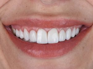 Image post by @sharpdentistry on Instagram