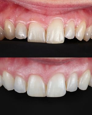 Image post by @fahaddentist on Instagram