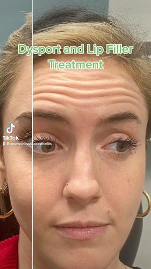 Video post by @anuaestheticsandwellness on Instagram