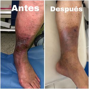 Image post by @dr.vicentevascular on Instagram