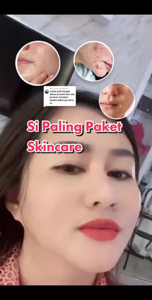 Video post by @lili.refliskin on TikTok