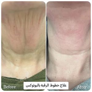 Image post by @dr.rafatalaker on Instagram