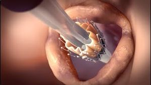 Video post by @nucleusmedicalmedia on YouTube