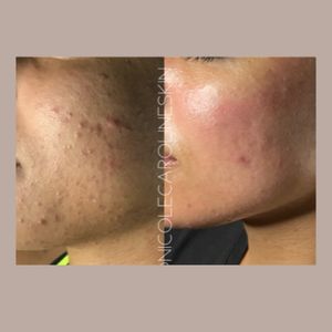 Image post by @nicolecarolineskin on Instagram