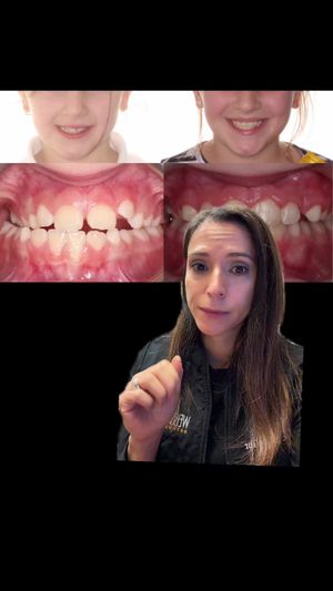 Video post by @weisstorortho on TikTok