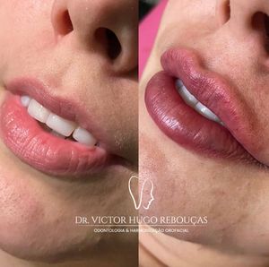 Image post by @dr.victorhugor on Instagram